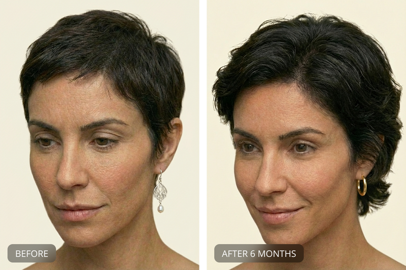 Before and After